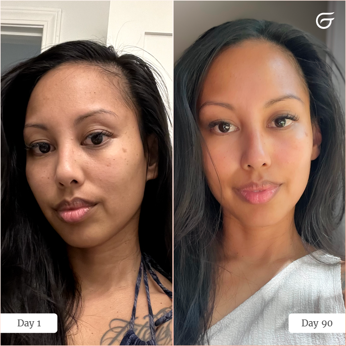 GlowUp™ LED Light Therapy Neck & Chest Mask