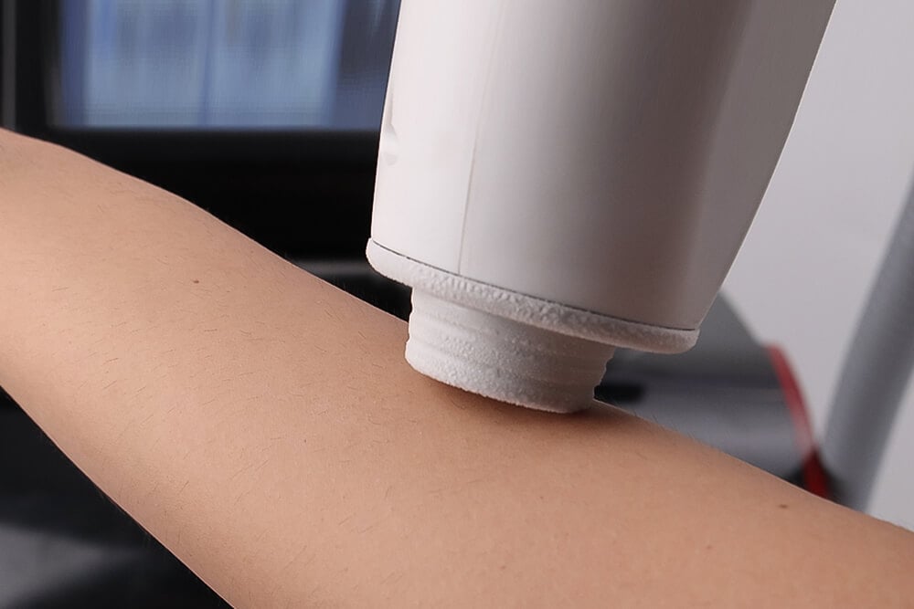 Konmison 5 Million Shots 808nm Diode Laser Hair Removal Machine