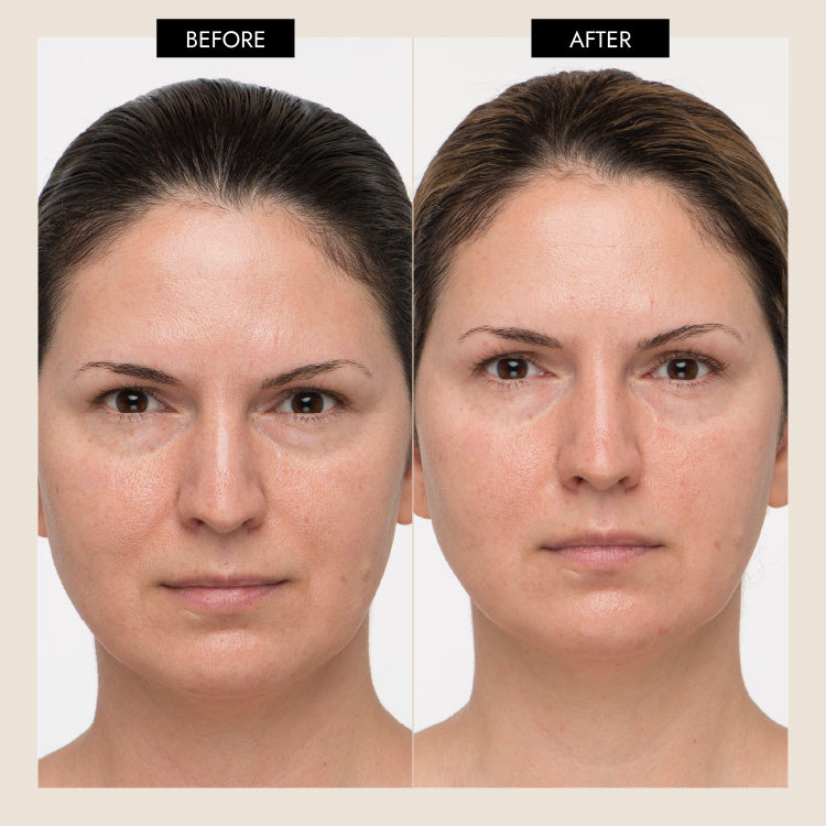 7E Wellness MyoLift Mini Spa Starter Kit