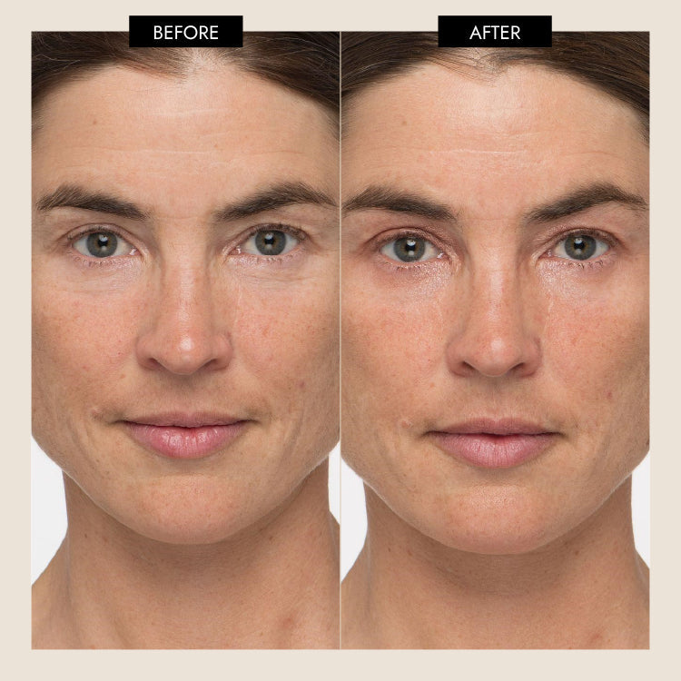 7E Wellness MyoLift Triwave Microcurrent Device