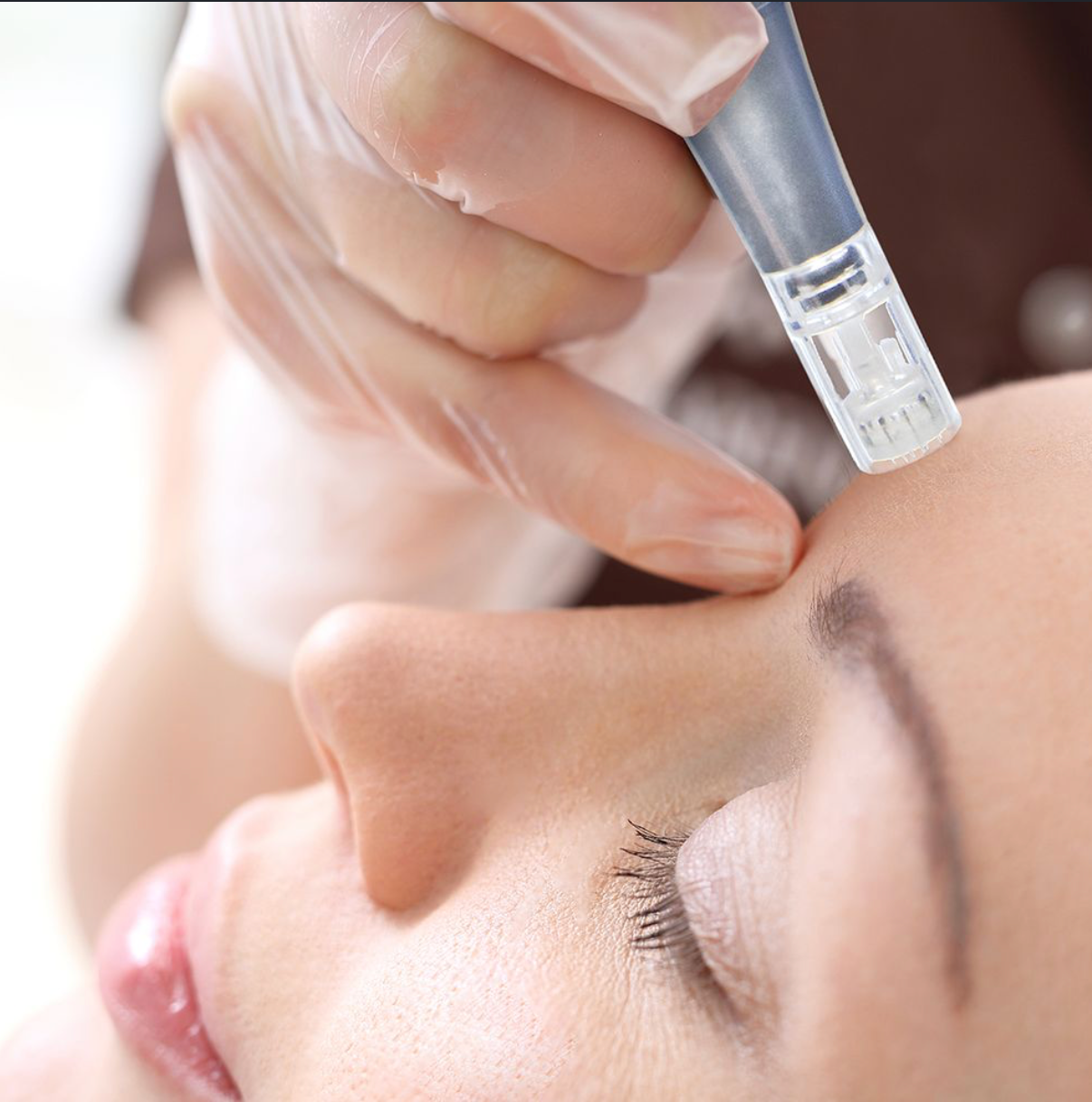 Microneedling Bio Pen Kit Bio Jouvance Paris Consumer