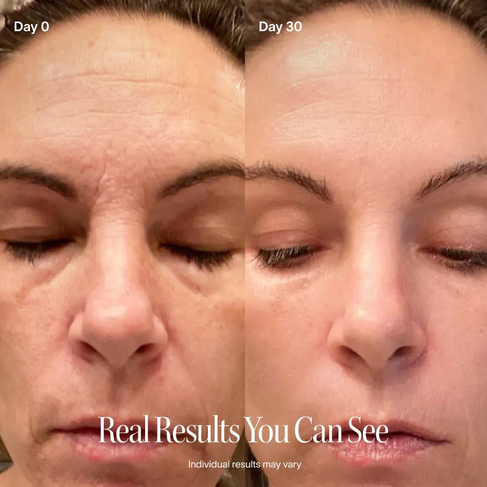 Solawave 4-in-1 Red Light Wand & Activating Serum Kit