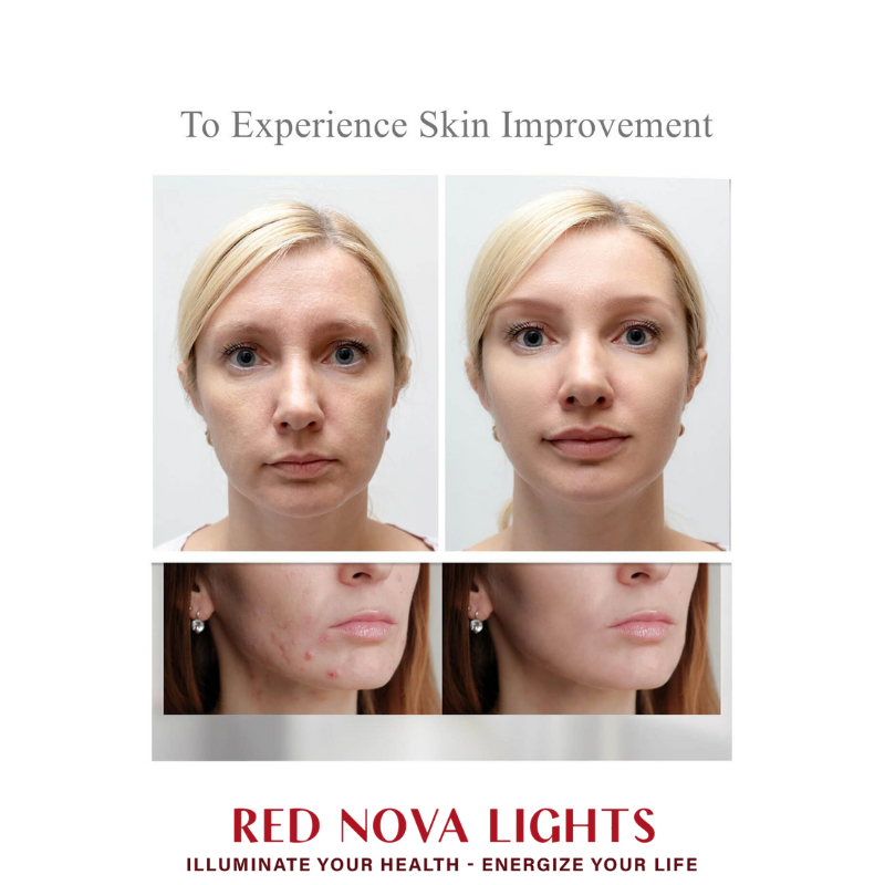 Red Nova Lights LED Face Mask with Red, Blue, Yellow + NIR