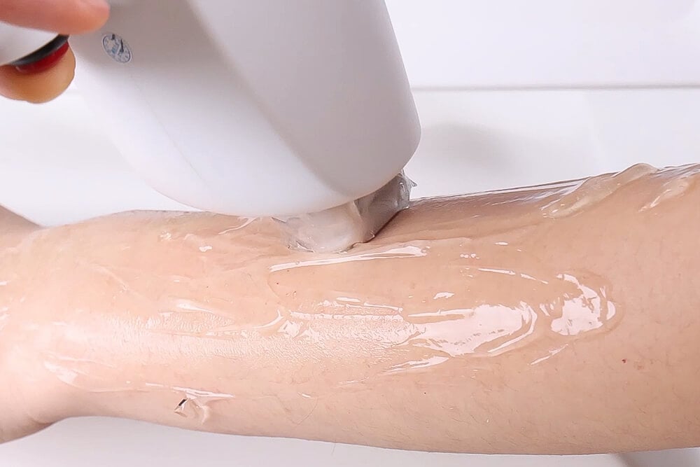 Konmison 1000W 808 Diode Laser Aesthetic Machine