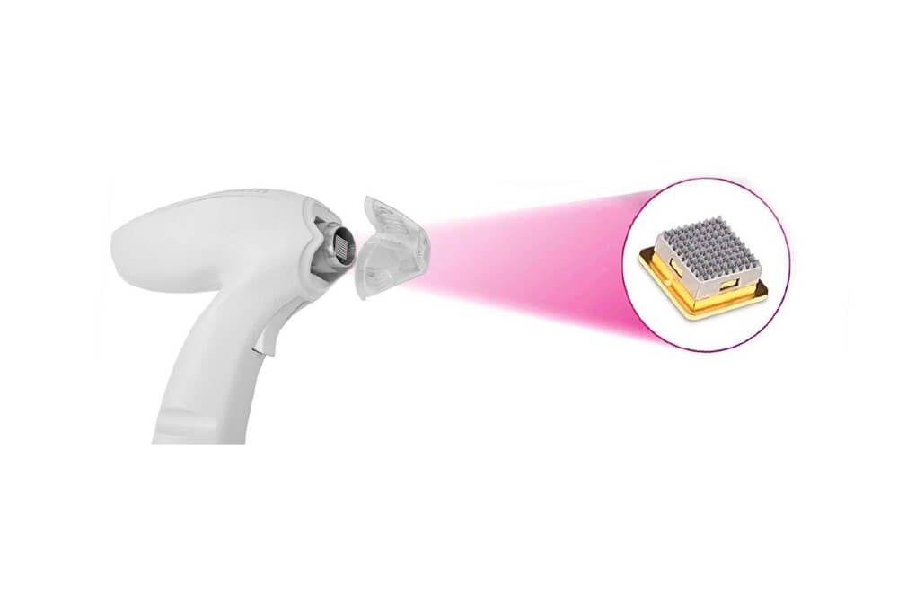 Konmison Portable Fractional RF Microneedling Machine