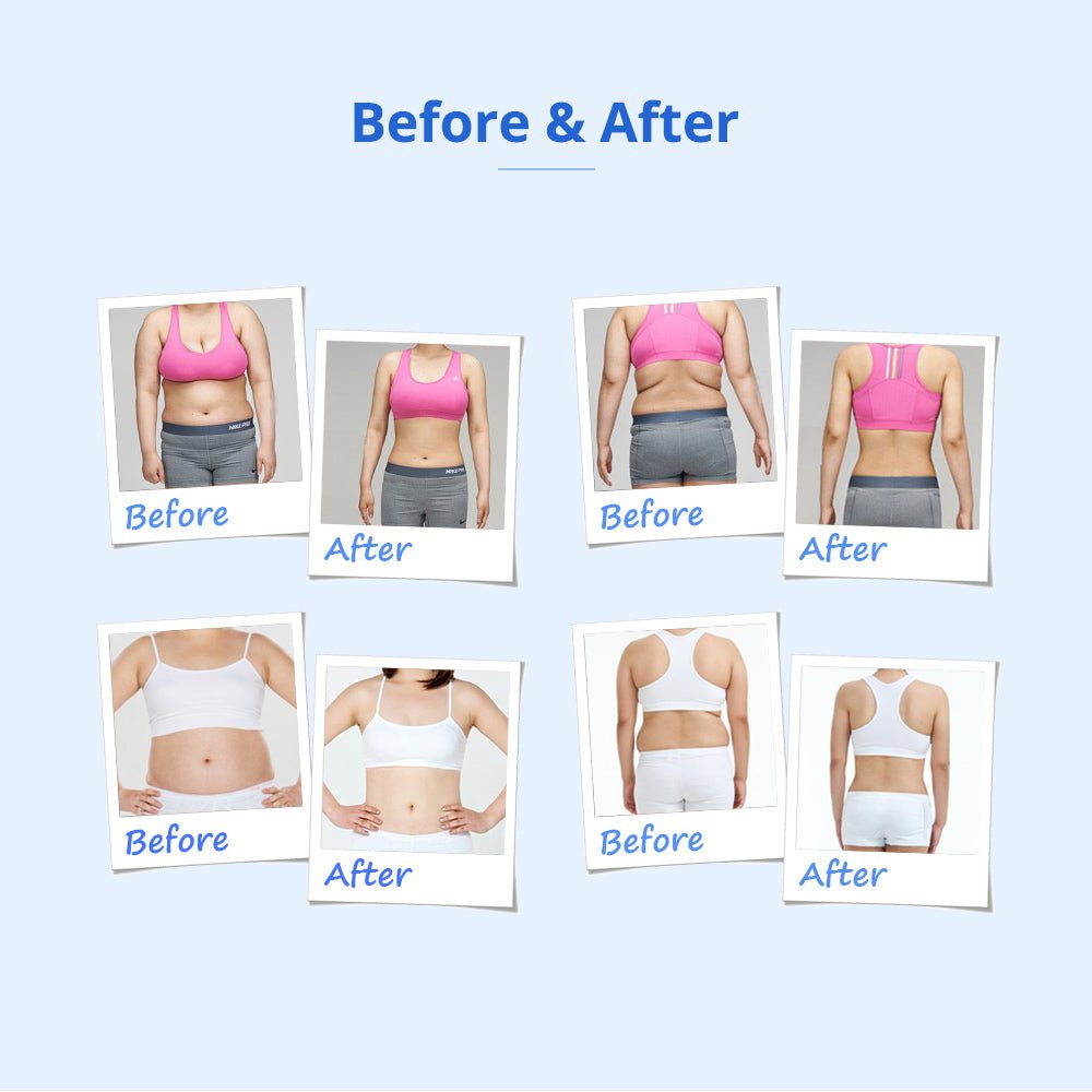 Shape Tactics 160mW Lipo Laser & Cavitation Cooling Contouring System