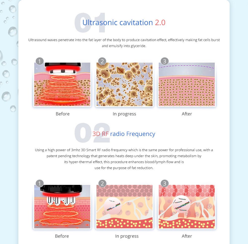 Shape Tactics 5-in-1 Cavitation Cryolipolysis Lipo Laser System