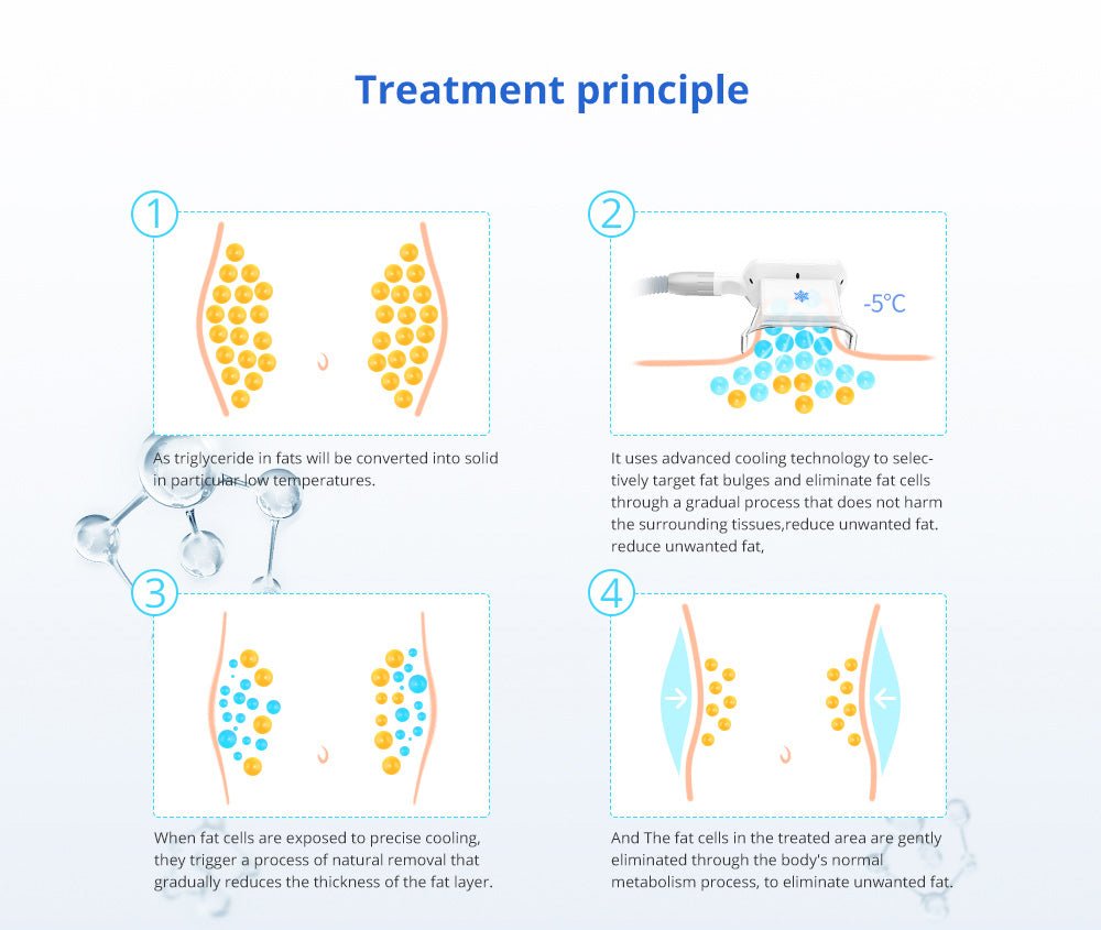 Shape Tactics 5-in-1 Cavitation Cryolipolysis Lipo Laser System