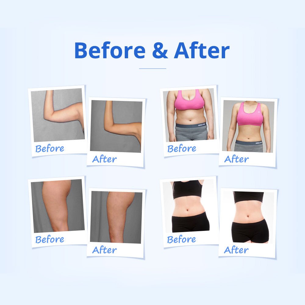 Shape Tactics 5-in-1 RF & 40K Cavitation Contouring System Cavitation Machines
