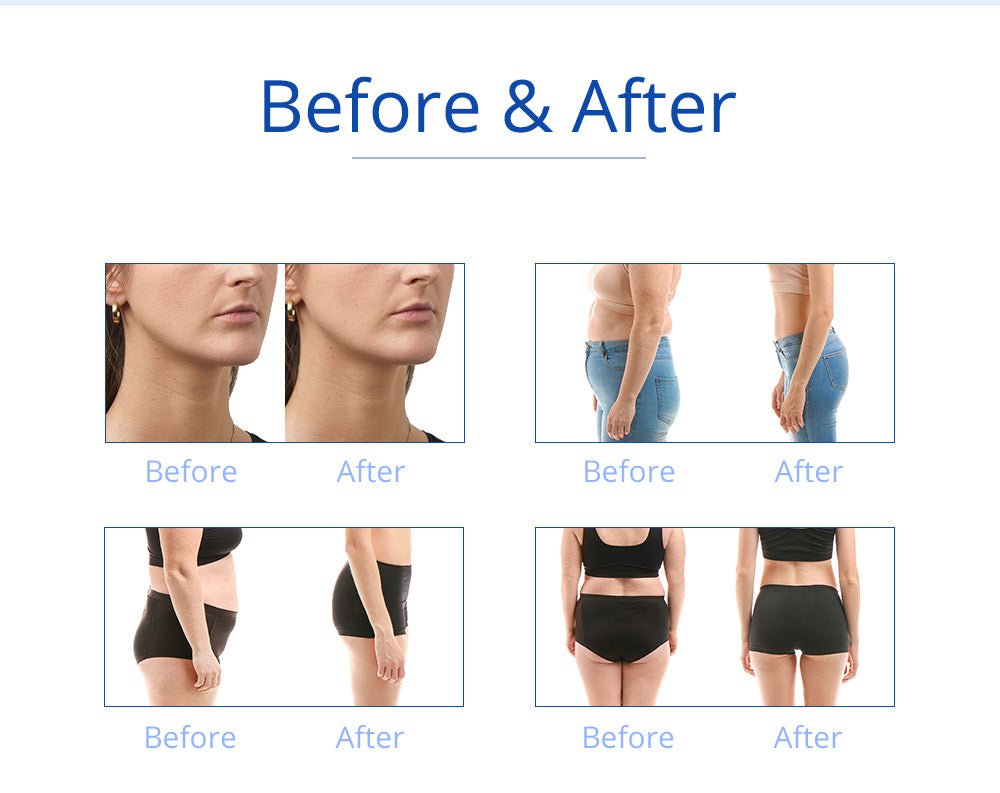 Shape Tactics 5-in-1 RF Cavitation Double-Handle Cryolipolysis Cooling System Cavitation Machines