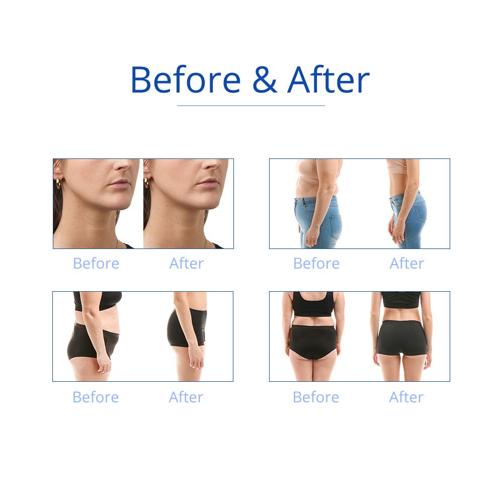 Shape Tactics 6-in-1 Cavitation RF Cryolipolysis Lipo Laser System Cavitation Machines
