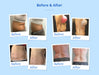 Shape Tactics Advanced Stand-Up Cooling Contouring System Cavitation Machines