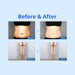 Shape Tactics Cryolipolysis Cold Vacuum Contouring System Cavitation Machines