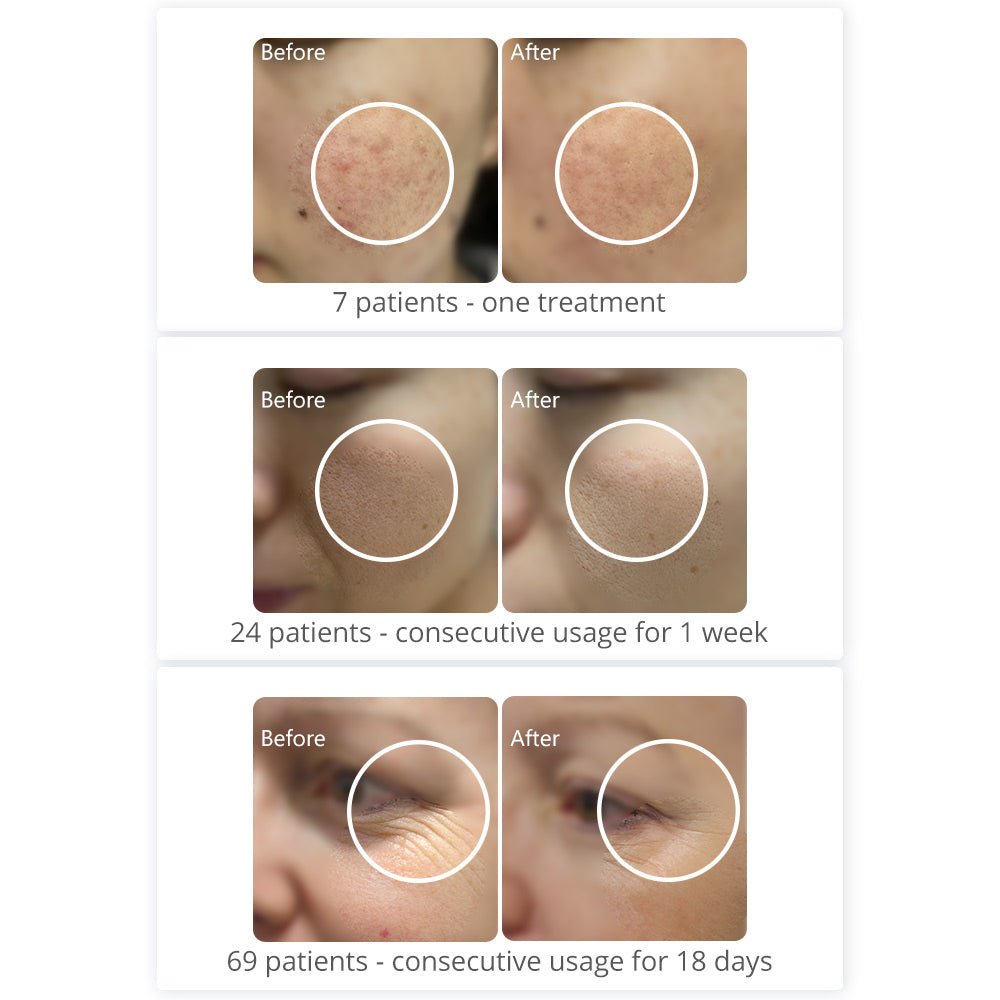 Shape Tactics PDT 408 LED Light System with Infrared Support