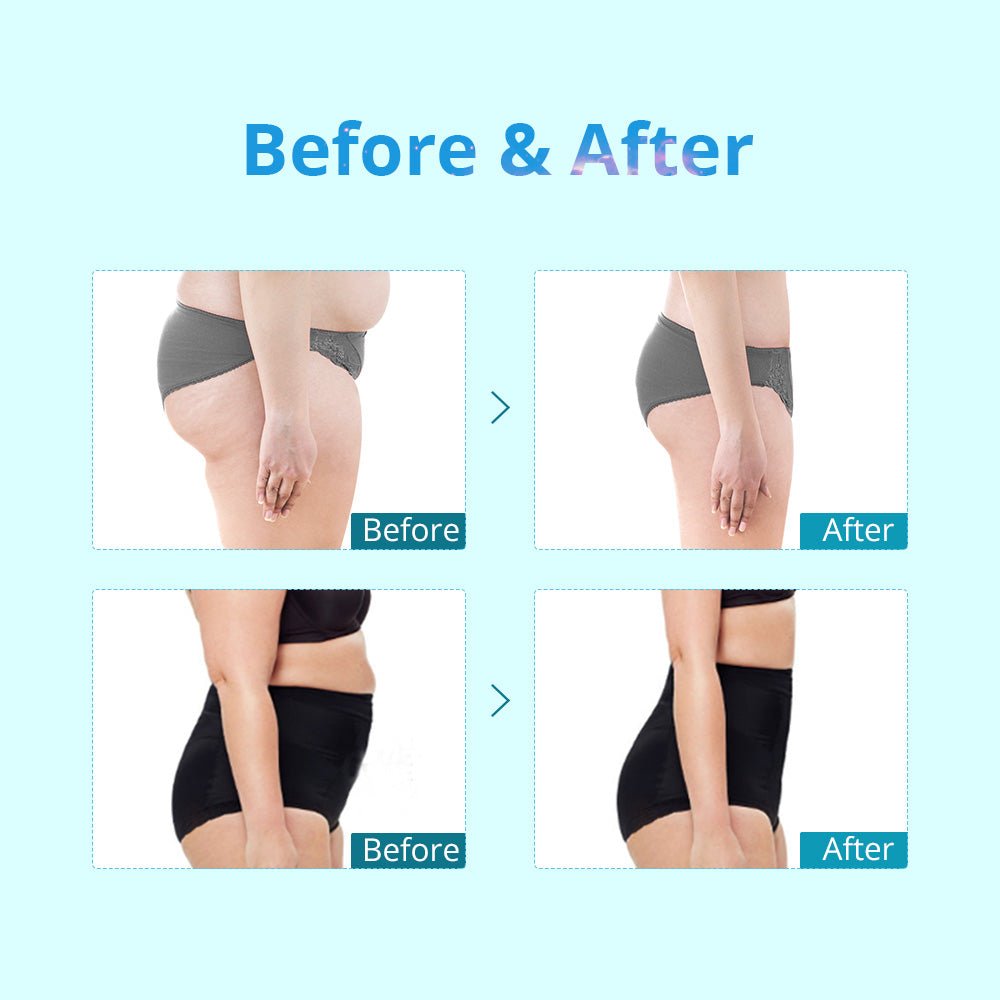 Shape Tactics Portable Double-Handle Cryolipolysis Contouring System Cavitation Machines