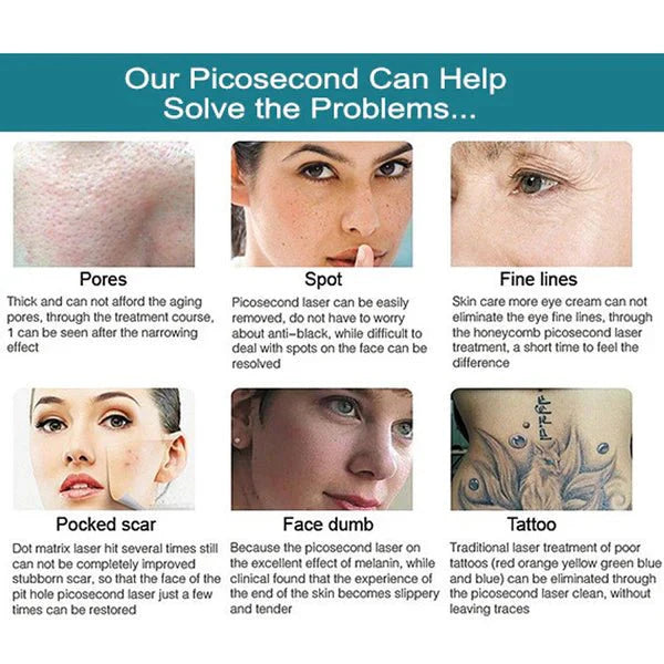 Shape Tactics Advanced Multi-Wavelength Picosecond Laser System