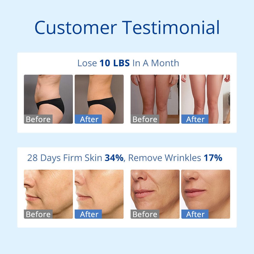 Shape Tactics S-Shape 30K Cavitation RF & 160mW Lipo Laser System Cavitation Machines