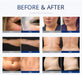 Shape Tactics S-Shape Pro 30K Cavitation RF Contouring System Cavitation Machines