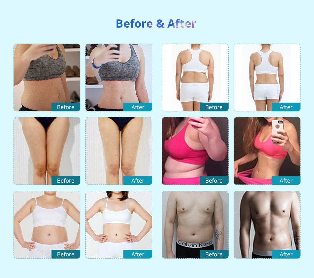 Shape Tactics Triple-Handle Cooling Vacuum Contouring System